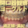 Orthodontics in Miki-Chan opening detector, eat yogurt