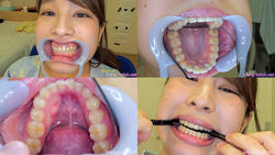 【歯フェチ】桜ちなみちゃんの歯を観察しました！