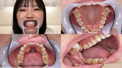 【치아 페티쉬】 카미시라 미오의 치아를 관찰했습니다!