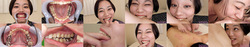 [With 3 bonus videos] Kana Hirai&#39;s teeth and bite series 1-3 collectively DL