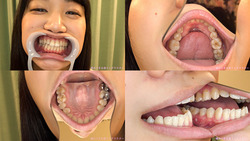 【歯フェチ】星川麻紀ちゃんの立派な天然歯を観察しました！【星川麻紀】