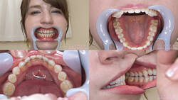 【歯フェチ】ジューン・ラブジョイちゃんの歯を観察しました！