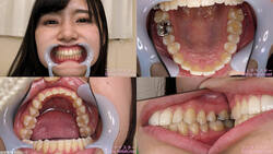 【치아 페티쉬】기쿠치 마야의 치아를 관찰했습니다!