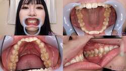 【치아 페티쉬】 스즈카 쿠루미의 치아를 관찰했습니다!