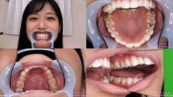 【치아 페티쉬】마에노 나나 짱의 치아를 관찰했습니다!