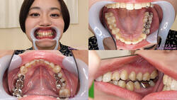 [Tooth fetish] I observed Kana Hirai&#39;s teeth!