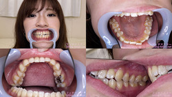 【치아 페티쉬】 무려! 저, 유리카와 사라씨의 치아를 관찰했습니다! 【영구 보존판】