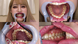 [Tooth fetish] I observed Hime Shirayuki&#39;s teeth!