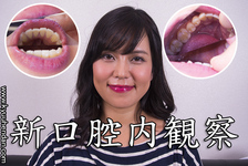 ♦ ️ [Dental fetish 14] ♦ ️ New oral observation ⭐️ Aki あ ️ by Oral hermit (Dr. X)‼ ️