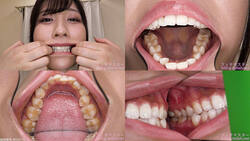 【치아 페티쉬】 츠지 사쿠라의 이빨을 관찰했습니다!