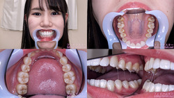 [Tooth fetish] I observed Miho Tomii&#39;s teeth!
